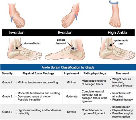 Rosh Review Ankle Sprain Classification Ortho