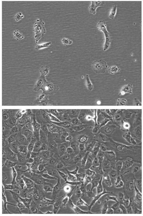 Ht Hnis Neo Fluc Puro Cell Line Imanis Life Sciences