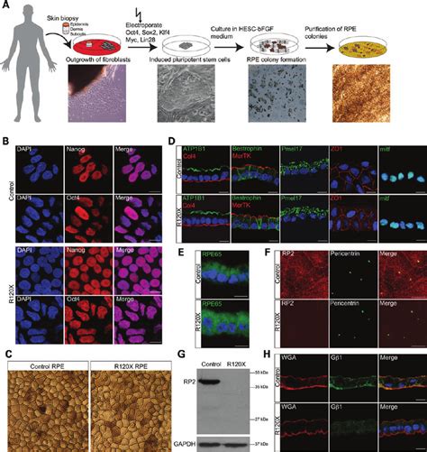 Generation Of Induced Pluripotent Stem Cells IPSCs And Retinal