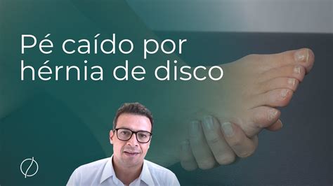 P Ca Do Por H Rnia De Disco Prof Dr Alberto Gotfryd M Dico