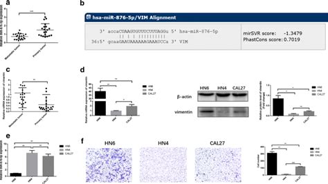 Mir 876 5p Modulates Head And Neck Squamous Cell Carcinoma Metastasis