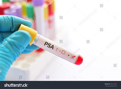 Blood Sample Positive Psa Prostatespecific Antigen Stock Photo