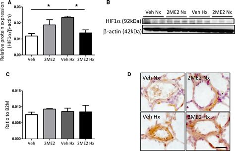 Influence Of 2‐methoxyestradiol And Sex On Hypoxia‐induced Pulmonary