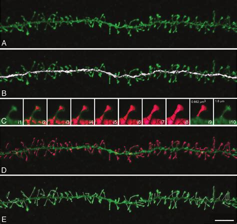 Dendritic Shaft And Dendritic Spine Reconstruction A Confocal