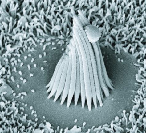 Difference Between Inner and Outer Hair Cells - Pediaa.Com