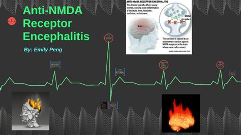 Anti-NMDA Receptor Encephalitis by Emily Peng on Prezi