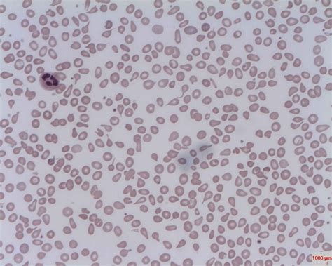 Red Blood Cell Inclusions