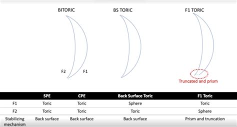 Cornea And Contact Lens Final Toric GP Lenses GP Materials