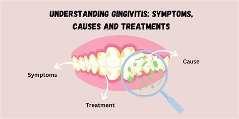 Understanding Gingivitis Gum Disease Symptoms Causes And Treatments