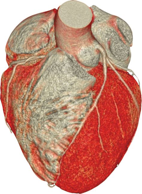 Choosing an appropriate heart test - Harvard Health