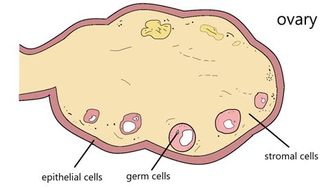 Ovarian cancer - HKOG-INFO