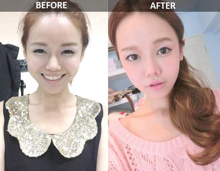 Hot girl Singapore bị chỉ trích vì ham phẫu thuật thẩm mỹ