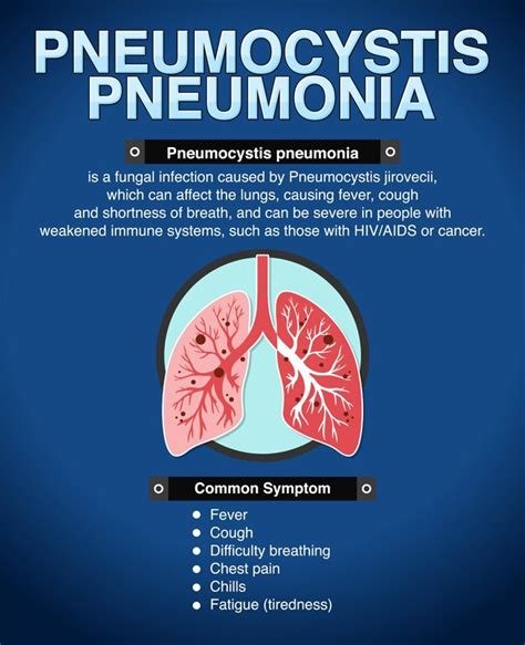 Pneumonia: Symptoms, Causes, and Effective Treatment - Tonic Arch