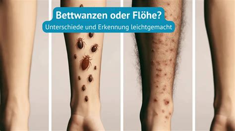 Bettwanzen oder Flöhe Unterschiede Erkennung leicht gemacht