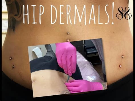 Hip Piercing Microdermal