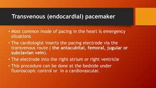 PACEMAKER PPT.pptx