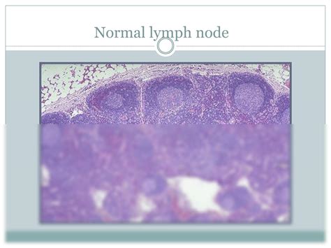 Solution Immunology And Amyloidosis Studypool