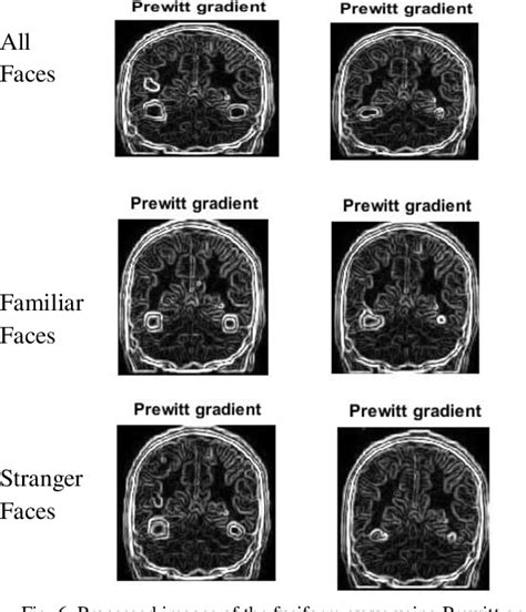 Figure 1 from Extraction of Fusiform Gyrus Area of Brain to Analyze ...