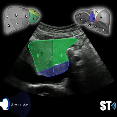 Couinauds Liver Segments Sonographic Tendencies