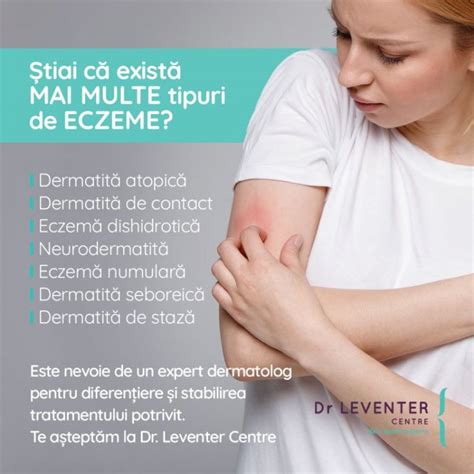 Eczema Tipuri Cauze Tratament Leventer Centre Bucure Ti