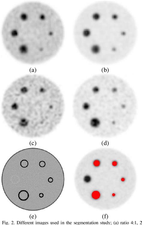 Figure 1 From A Fuzzy Locally Adaptive Bayesian Segmentation Approach