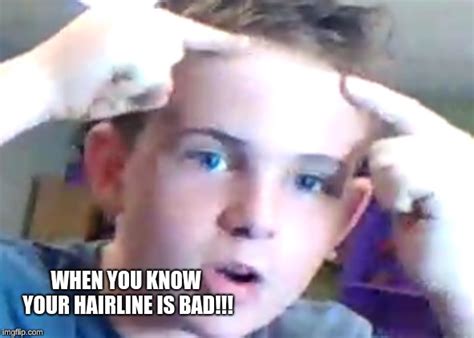 Funny Hairline Memes : 100 Funny Pictures For Today 57 Funnyfoto ...