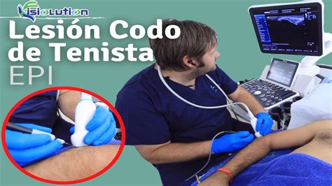 Tratamiento De Fisioterapia Recomendado Para La Epicondilitis O Codo