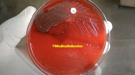 Streptococcus Pneumoniae Introduction Morphology Pathogen