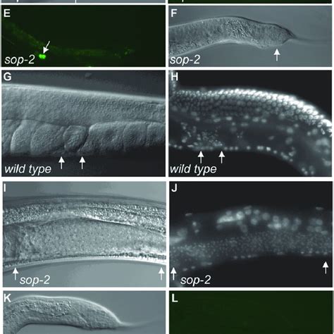 Hermaphrodite To Male Sexual Transformations In Sop 2 Mutants A The Download Scientific