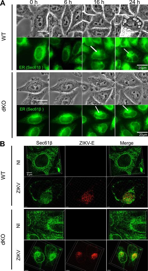 Impact Of ATL On ZIKV Induced ER Relocation HeLa WT Or DKO Cells