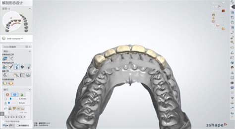 3shape形态课必备教程17讲医疗器具诊断治疗3shape口腔 仿真秀视频课程