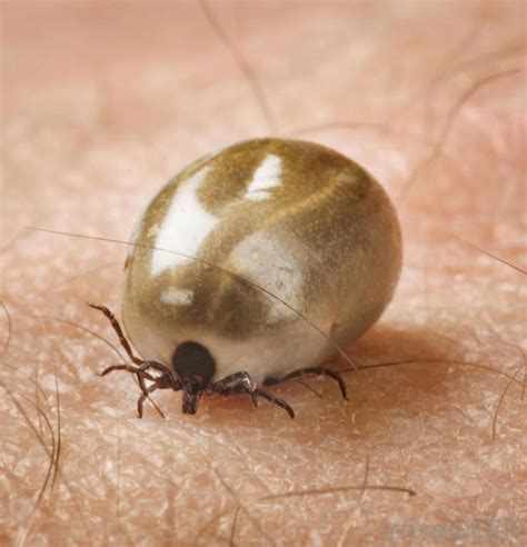 How To Remove A Tick From Your Pet Animed Direct