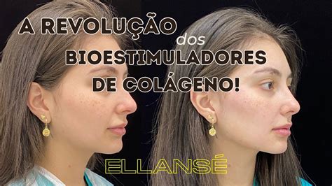 O Que Ellans Como Funciona Bioestimulador De Col Geno Volumizador