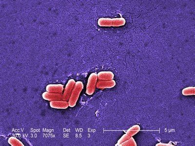 E. Coli Infection In Humans |IYTHEALTH.com