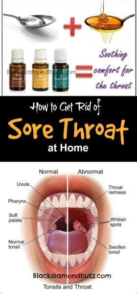 Essential Oil For Sore Throat That Work Fast