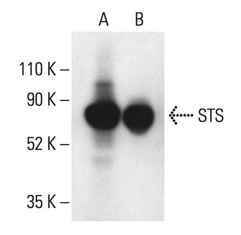 Steroid Sulfatase STS Antibody A 6 SCBT Santa Cruz Biotechnology