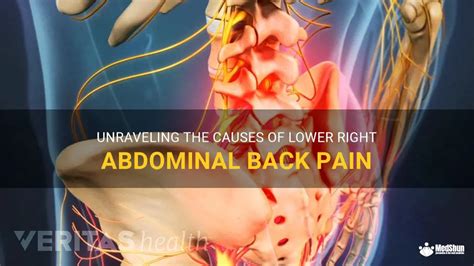 Unraveling The Causes Of Lower Right Abdominal Back Pain Medshun