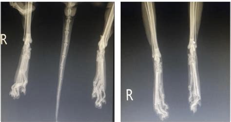 Case 9 A/P radiography of the fracture in the right and left tarsal ...