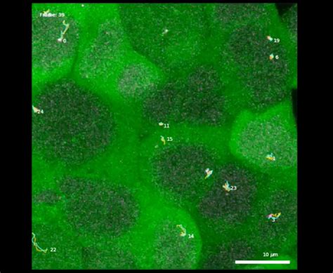 Mit Research Team Uses Super Resolution Live Cell Imaging To Study Dna