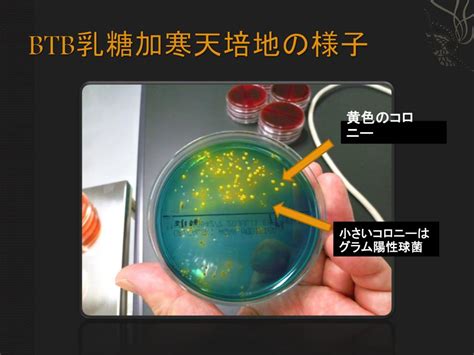 PPT - 消毒前 PowerPoint Presentation, free download - ID:6090770