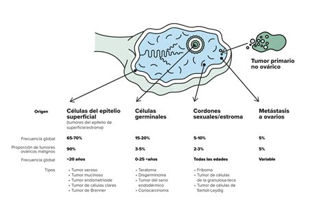 Cáncer De Ovario ¿qué El Cáncer De Ovario PortalclÍnic