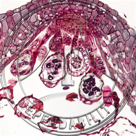 Polypodium Polypodioides Leaflet Cs Attached Sporangia Prepared