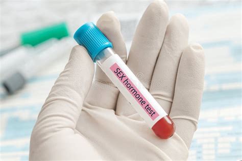 Blood Sample For Study Of Levels Of Sex Hormones Tests Doctor Holding