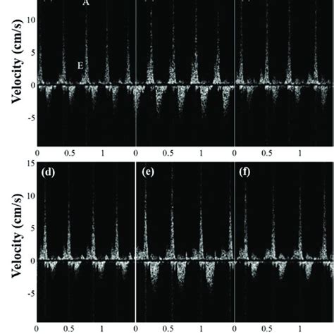 Spectral Doppler Waveforms Acquired From The Adult Zebrafish A One