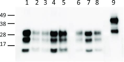 Western Blot Analysis Of Macaque Brain Homogenates And Inocula