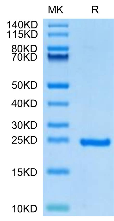 Buy Human Sonic Hedgehog Shh Protein Shh He Ka