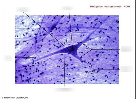 Multipolar Neuron Labeled Under Microscope