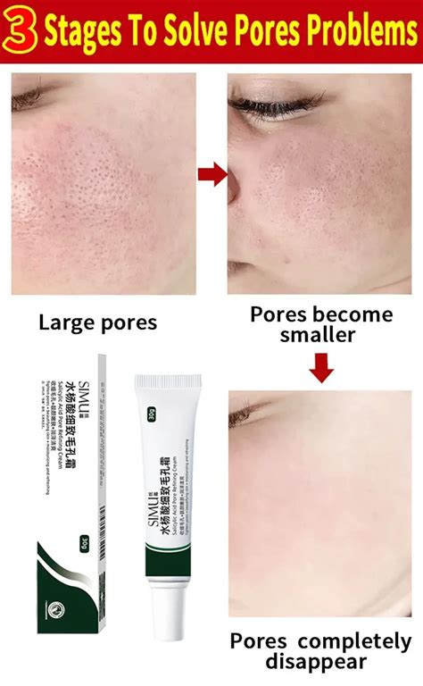 Средство для сужения пор с салициловой кислотой, крем для очищения пор ...