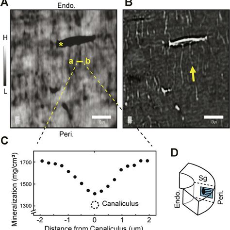 The lacuno-canalicular-bone canal network. Osteocyte canaliculi are ...