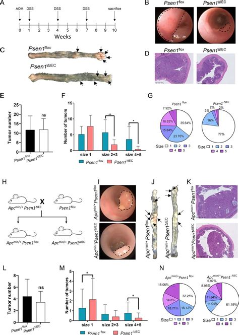 Epithelial Presenilin 1 Drives Colorectal Tumour Growth By Controlling